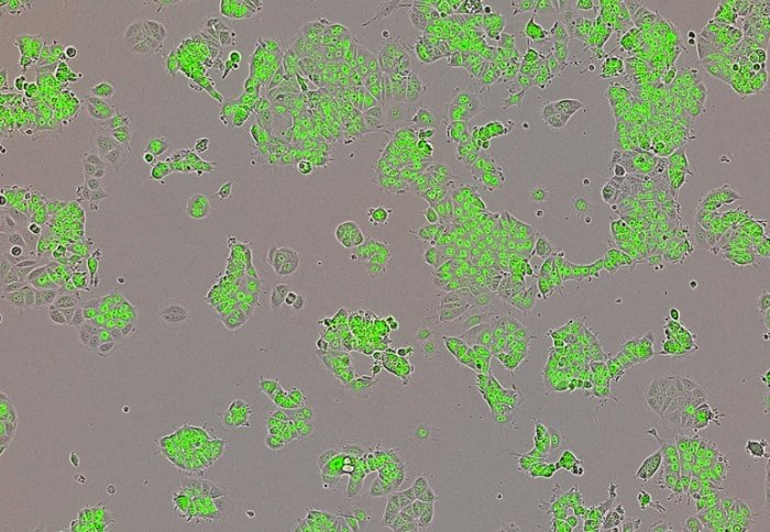 Breast Cancer Fuelled By Mysterious Yin Yang Protein AHSC